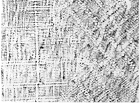 Fig.9 Austenite dendrites in hypereutectic cast iron.